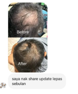 O Shape